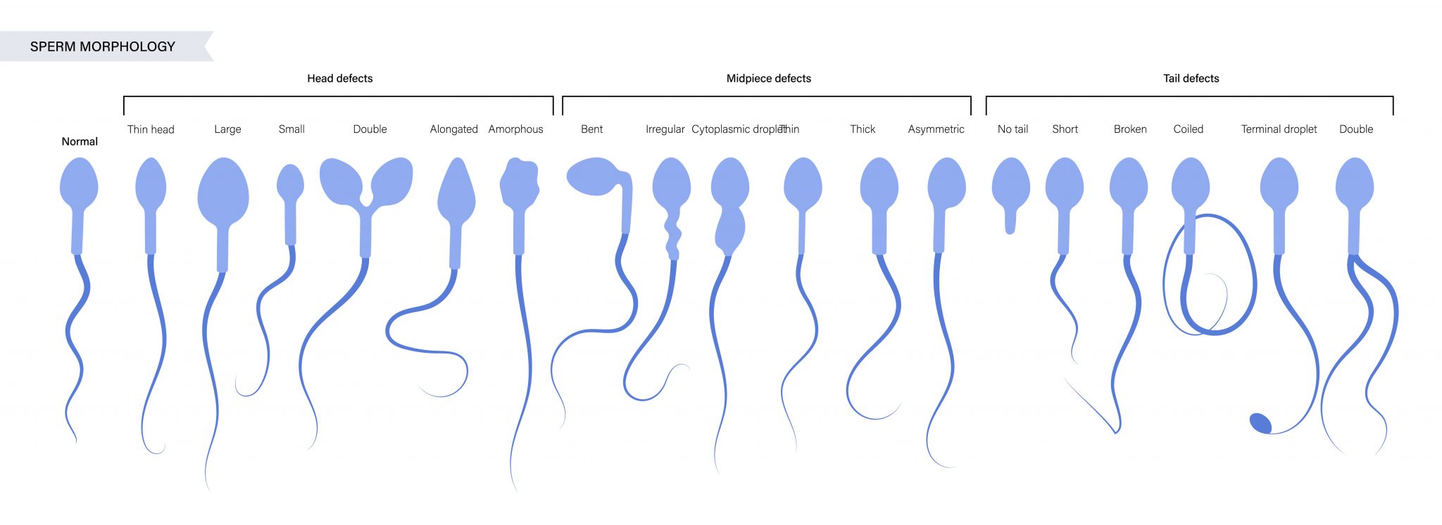 A Guide To Sperm Cells And Their Functions Ivi Uk