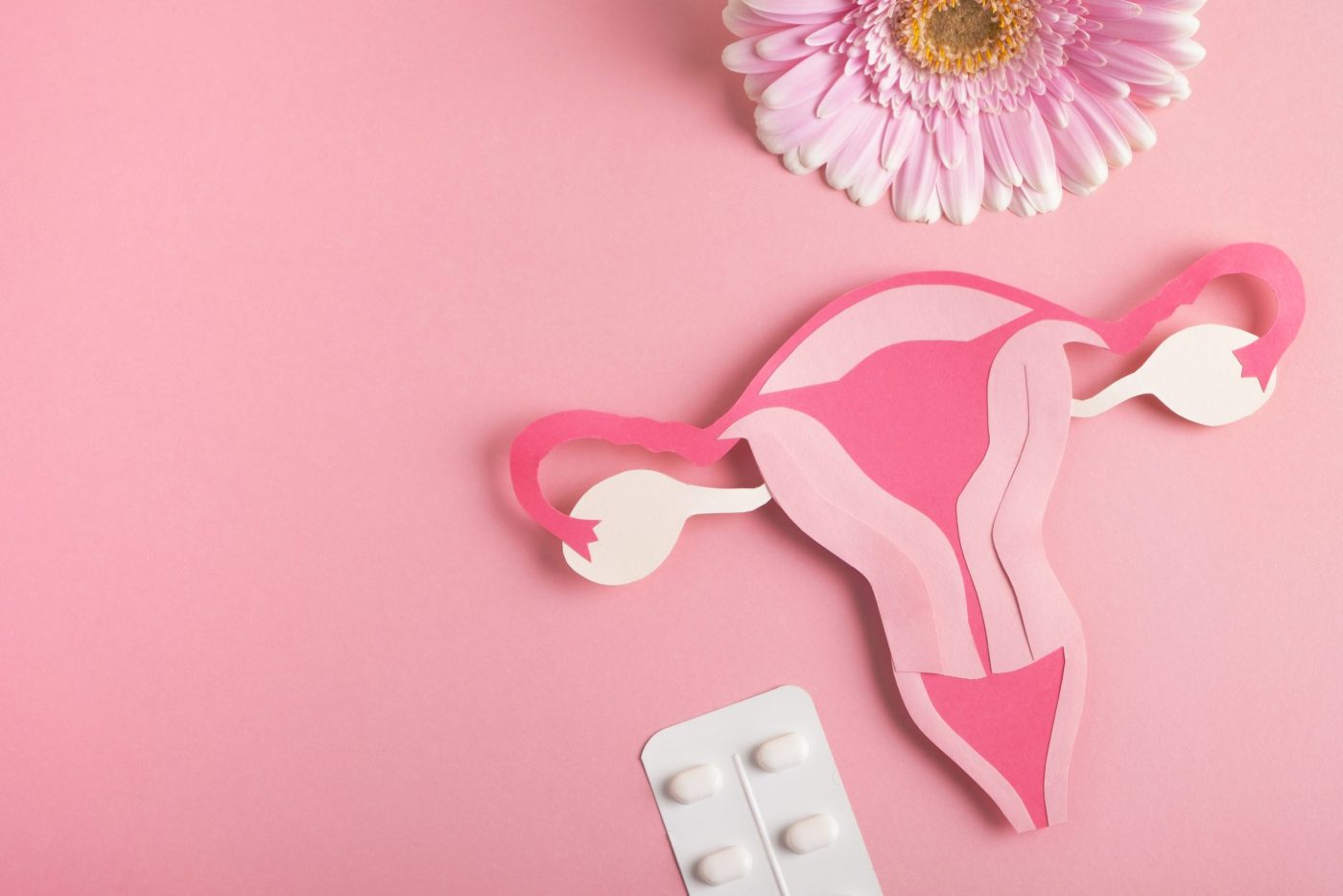 Endometrial Hyperplasia: Causes, Symptoms, Treatment
